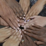 A woman with visible pigmentation on her neck and temples, symbolizing awareness and acceptance of skin conditions on International Skin Pigmentation Day.